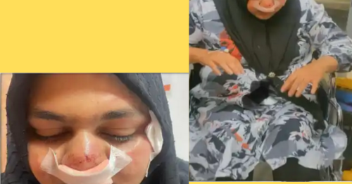 MDP Candidate Brutally Attacked